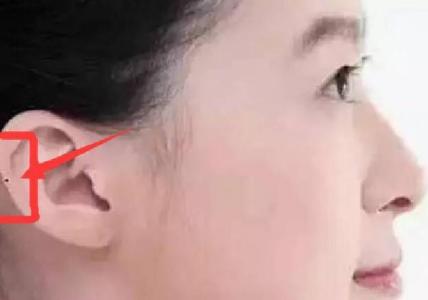 女人耳背有痣代表什么 是好痣吗 女人耳背后有痣图解