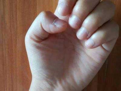 指甲算命：手指没有月牙代表着什么？ 手指指甲月牙上变紫