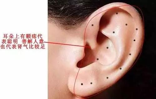 右边耳朵里有痣代表什么含义？ 耳朵后面有痣代表什么