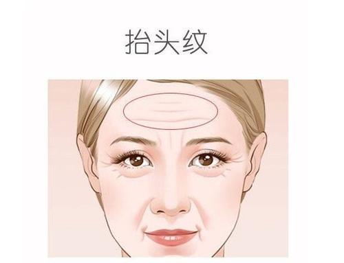 女人抬头纹面相分析 健康长寿好福气 面相抬头纹