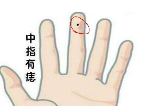 告诉你手指指缝有痣代表什么意思 手指缝痣
