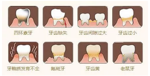 牙齿缝隙大代表什么命 下牙齿有缝隙代表什么