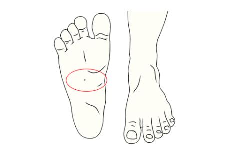 脚底有痣代表什么 女人右脚底有痣全图解
