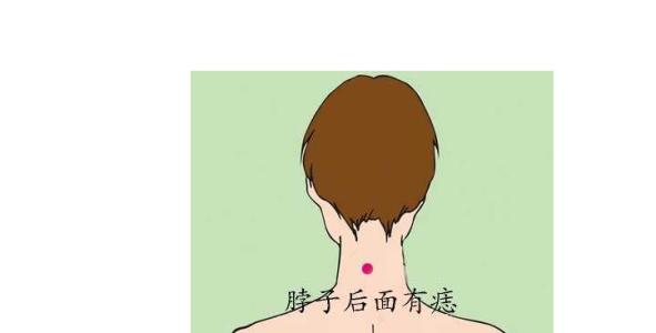 脖子后面中间有痣代表什么意思？ 脖子中间有痣