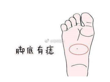 脚趾长痣的含义