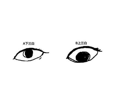 上三白眼和下三白眼的区别 什么是下三白眼