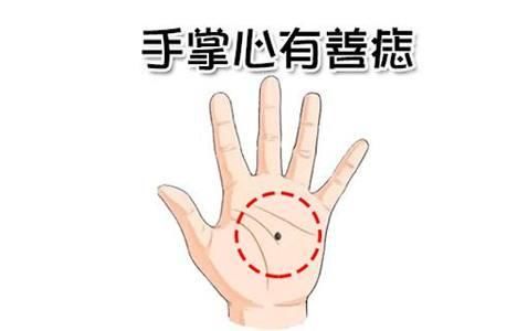 手掌有痣 手掌心有痣代表什么 手掌心有痣代表什么