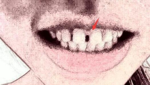 牙齿稀疏的人是不是更喜欢撒谎 牙齿稀疏
