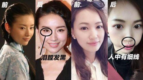 女性出轨的面相特征 什么面相的女人容易出轨