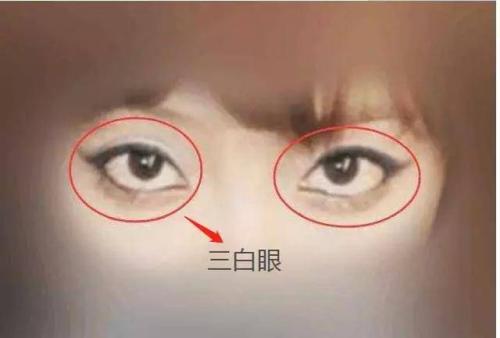 女人下三白眼面相解析 上三白眼的女人面相
