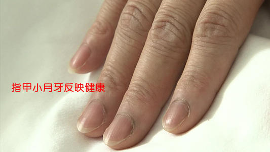 指甲半月痕的健康运势分析 小指甲大用处 指甲半月痕