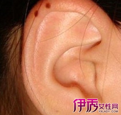 左耳下面有痣代表什么意思？ 左耳下方脖子有痣的女人