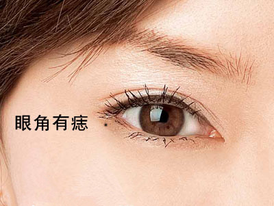 眼角有痣代表什么 左眼角是吉兆 内眼角有痣代表什么