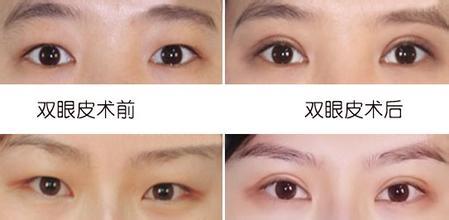 双眼皮和单眼皮运势性格都有什么特点 单眼皮和双眼皮性格