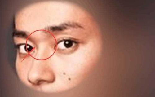 鼻子短的人面相解析,鼻子短意味着什么？ 山根短的面相